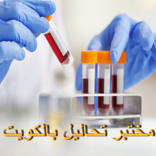 مختبر - مختبر تحاليل طبية – بالكويت 60900553 – مختبر تحاليل -رقم مختبر – تحاليل منزلية – مختبر تحاليل الكويت – مختبر تحاليل خدمة منازل – ارخص مختبر تحاليل بالكويت – مختبر تحليل دم ٢٤ ساعة – افضل مختبر تحاليل في الكويت